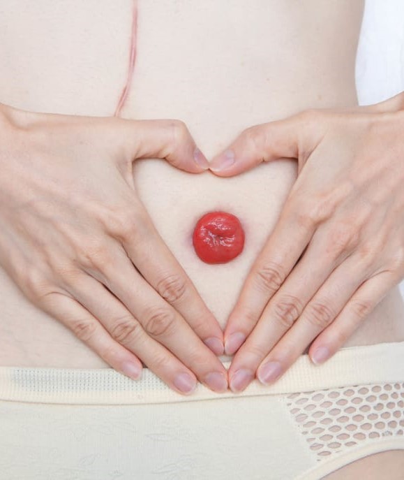 stoma love 1030x687 2 A Propos stoma love 1030x687 2 A Propos